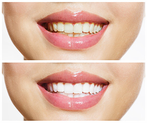 Dr Joy Dental Dubai